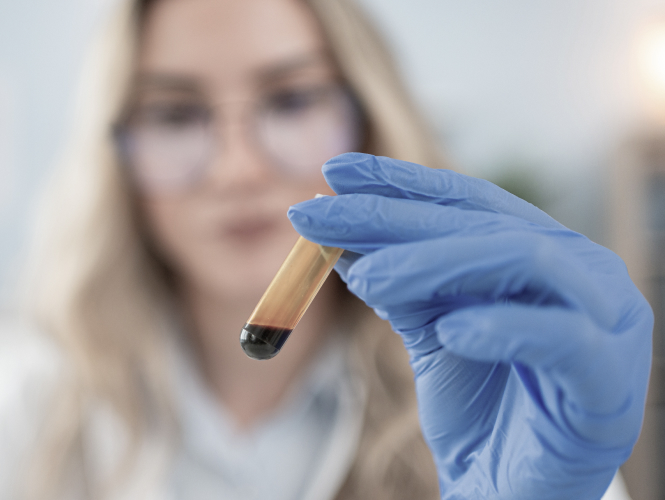 LAB LEVELS AND<br />
WHAT THEY MEAN