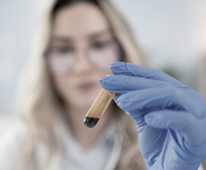 LAB LEVELS<br />
AND WHAT THEY MEAN